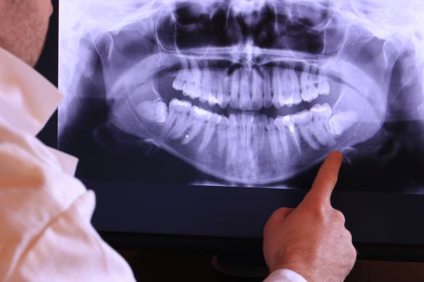 Best Emergency Treatment for Dental Infections or Abscesses in Northfield, NJ
